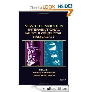 New Techniques in Interventional Musculoskeletal Radiology E 