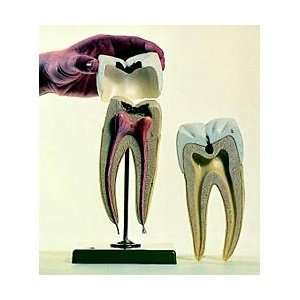  SOMSO® Molar With Caries Model Industrial & Scientific