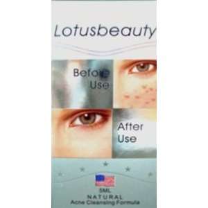  Lotusbeauty Natural Acne Cleansing Formula Beauty