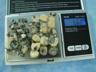 Today we are offering 56.2 Grams of Scrap Dental. May contain platinum 